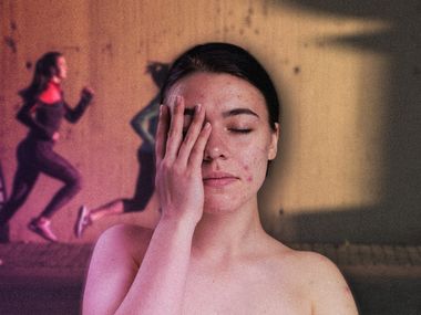 PCOS a hyperandrogenizmus: Ktoré doplnky výživy majú zmysel (+ praktická tabuľka)