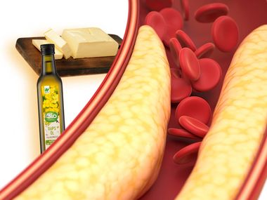 Tuková vojna: Pravda o rastlinných olejoch, ketogénnej diéte a cholesterole