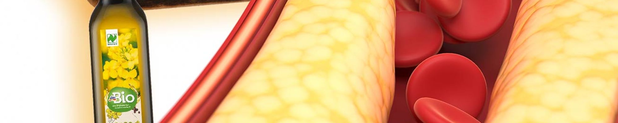 Tuková vojna: Pravda o rastlinných olejoch, ketogénnej diéte a cholesterole